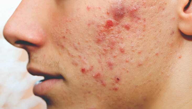 Homeopathic solutions for Cosmetic treatment