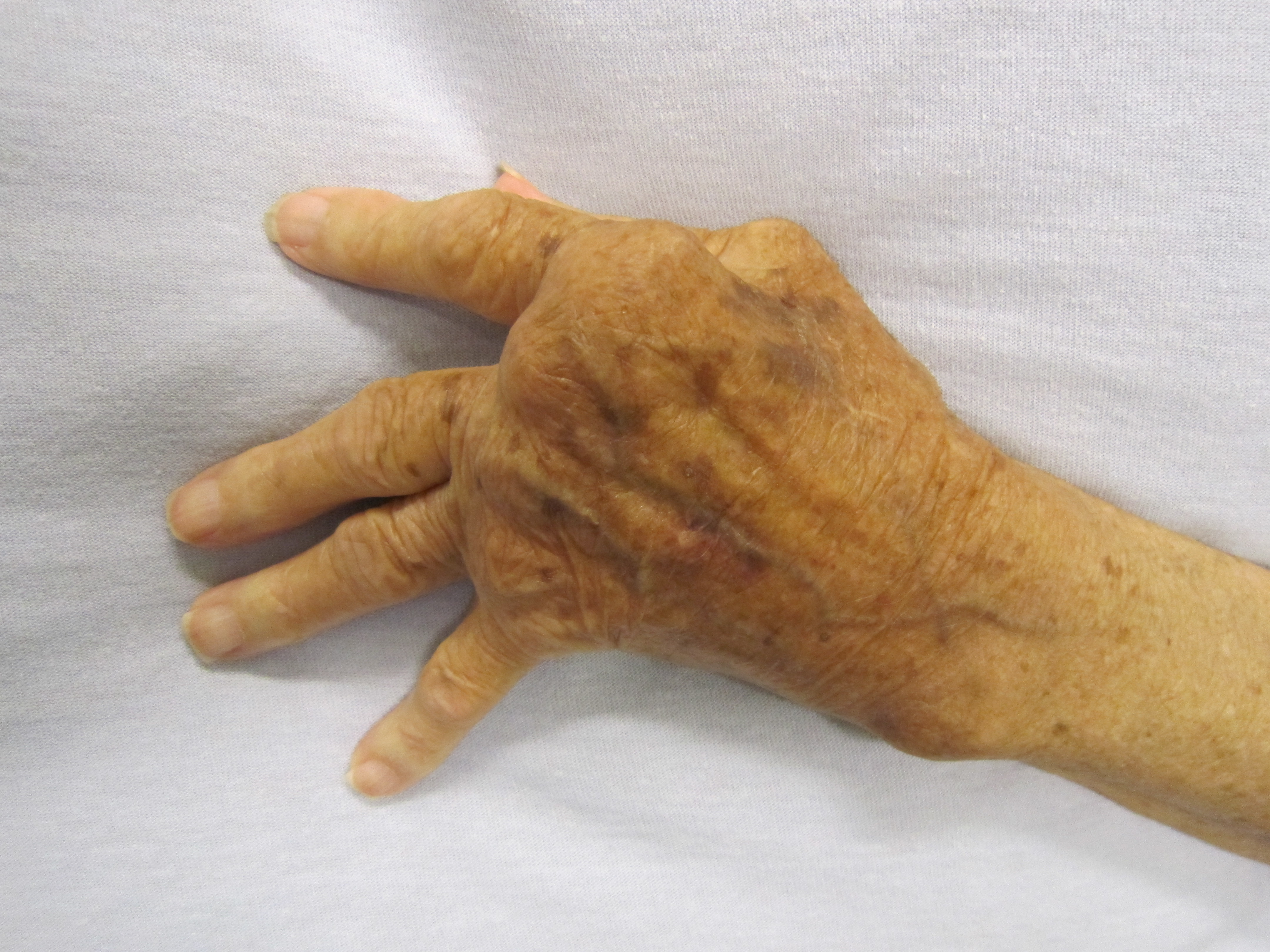 Homeopathic solutions for Orthopaedic Disorder