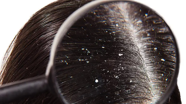 Homeopathic solutions for Cosmetic treatment