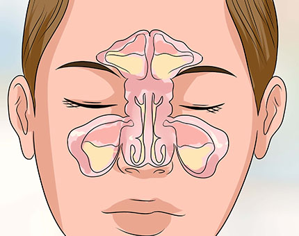 Homeopathic solutions for Respiratory Disorder